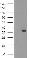Monoclonal Mouse anti-Human CNN2 Antibody (clone OTI2B5, IHC, IF, WB)