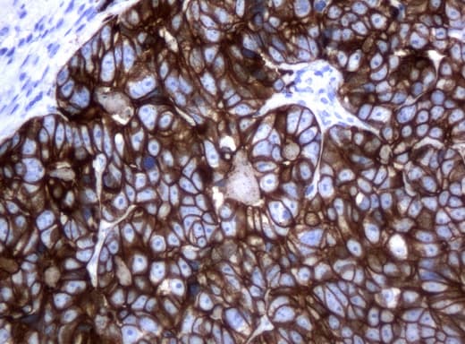 KRT18 / CK18 / Cytokeratin 18 Antibody (aa69-372, clone UMAB50)