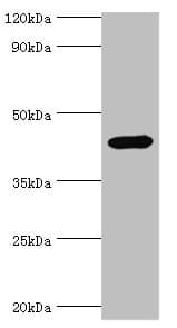 CD121b / IL1R2 Antibody (aa20-320)