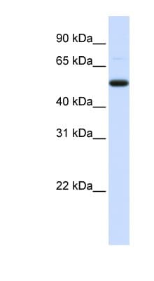 DCP2 Antibody (aa324-373)
