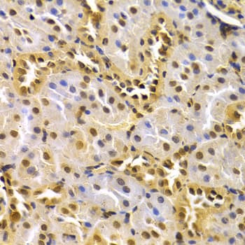 Polyclonal Rabbit anti-Human CDK4 Antibody (IHC, IF, WB)
