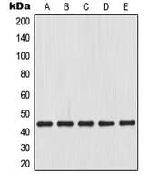 Polyclonal Rabbit anti-Human MAP2K4 / MKK4 Antibody (Internal, WB)