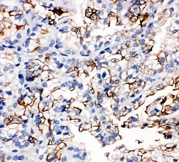 AQP1 / Aquaporin 1 Antibody (aa251-269)