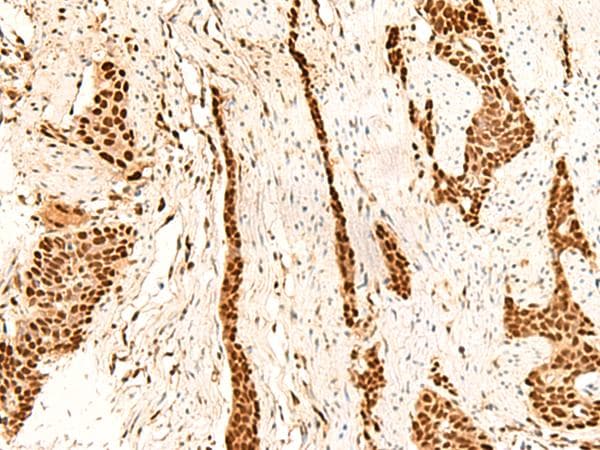 METTL1 Antibody