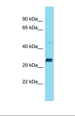 SPT7L / SUPT7L Antibody (aa51-100)