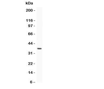 Polyclonal Rabbit anti-Human Estrogen Receptor Antibody (aa425-595, IHC, WB)