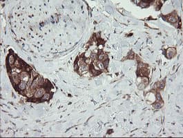 TPD52L3 Antibody (clone OTI4C12, Carrier-free)