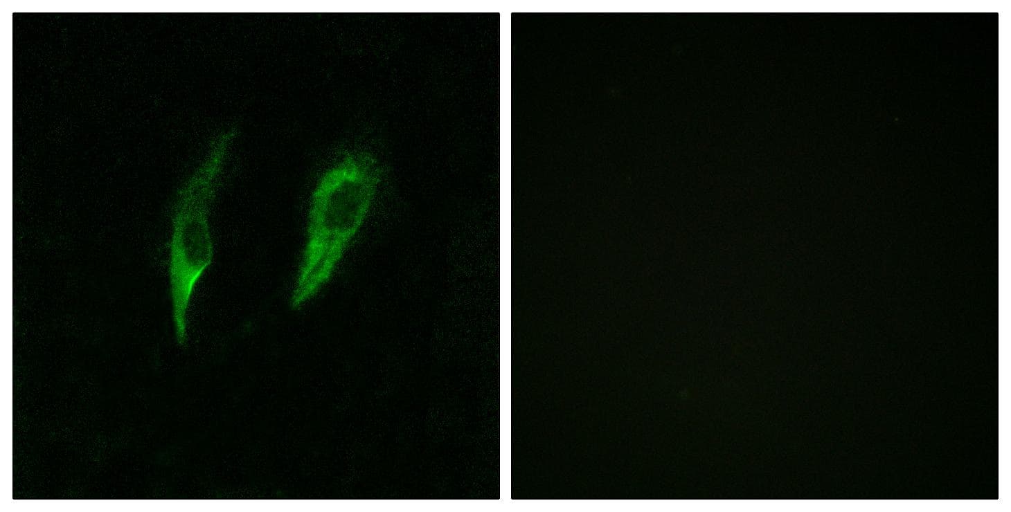 Polyclonal Rabbit anti-Human IRAK3 / IRAKM / IRAK-M Antibody (IHC, IF, WB)