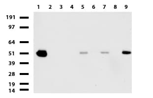 ABAT Antibody (aa29-323, clone UMAB179, Carrier-free)