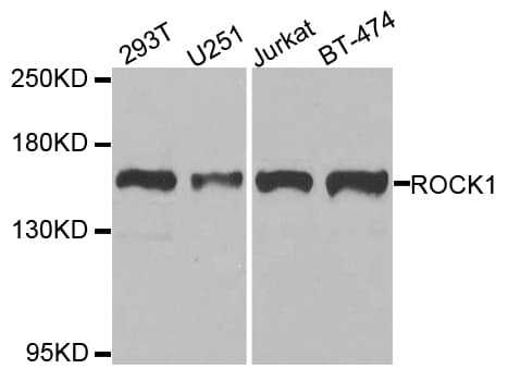 Rho Kinase / ROCK1 Antibody
