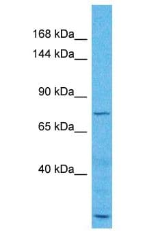 ZMYM6 Antibody (aa17-66)