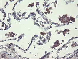 RPN1 / Ribophorin I Antibody (clone OTI5B1, Carrier-free)