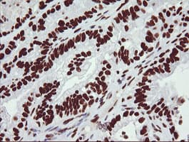 NONO / P54NRB Antibody (clone OTI3F8)