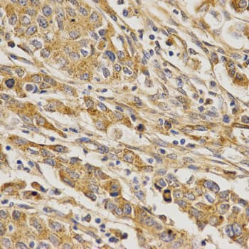 BAIAP2 / IRSP53 Antibody