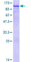 Human HBS1L Protein (Recombinant GST)