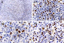 Polyclonal Rabbit anti-Human MALT1 Antibody (aa646-885, IHC, WB)
