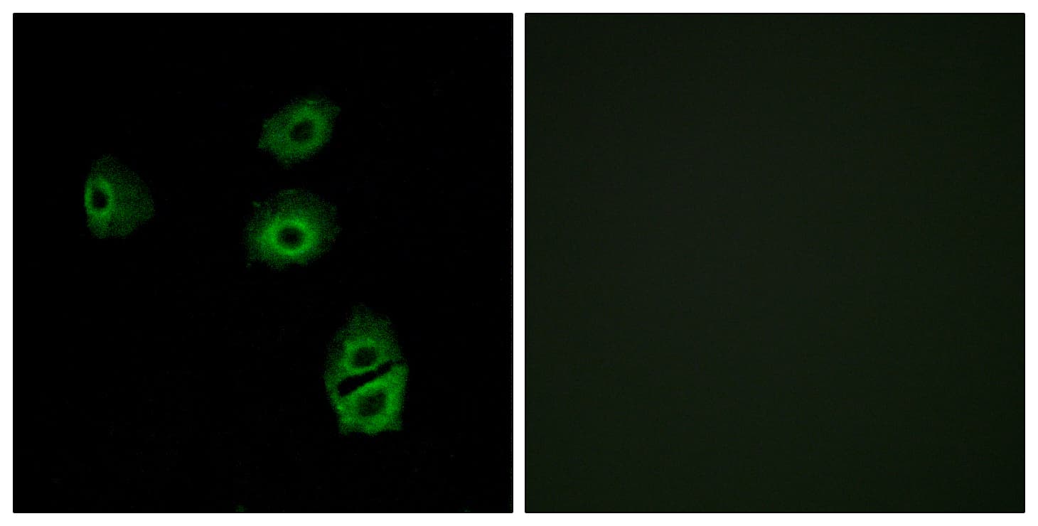 Polyclonal Rabbit anti-Human OR2B2 Antibody (aa241-290, IF, WB)
