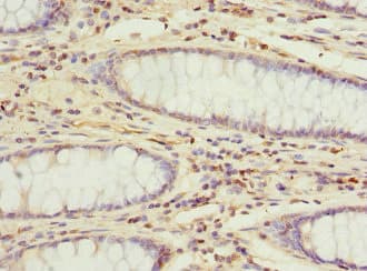 DDX20 / GEMIN3 Antibody