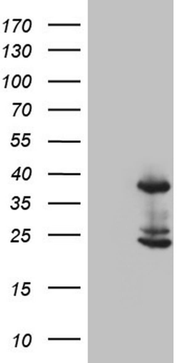 CASP4 / Caspase 4 Antibody (aa81-270, clone OTI9F6, Carrier-free)