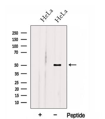 HOXA10 Antibody