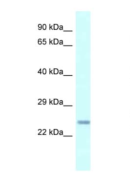 Polyclonal Rabbit anti-Mouse CDKN3 / KAP Antibody (aa67-116, IHC, WB)
