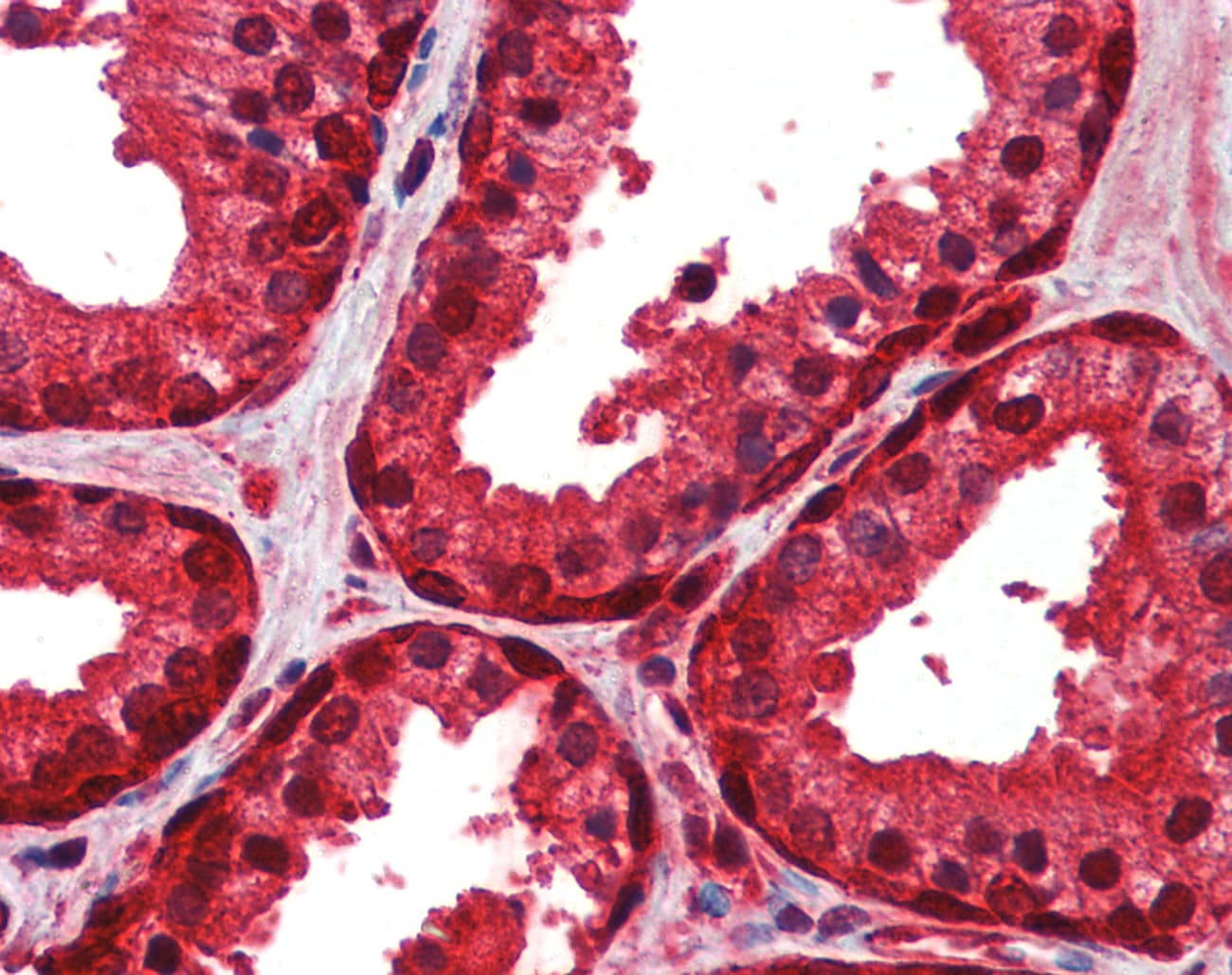 PathPlus™ Polyclonal Rabbit anti-Human ENO1 / Alpha Enolase Antibody (aa246-295, IHC, WB)