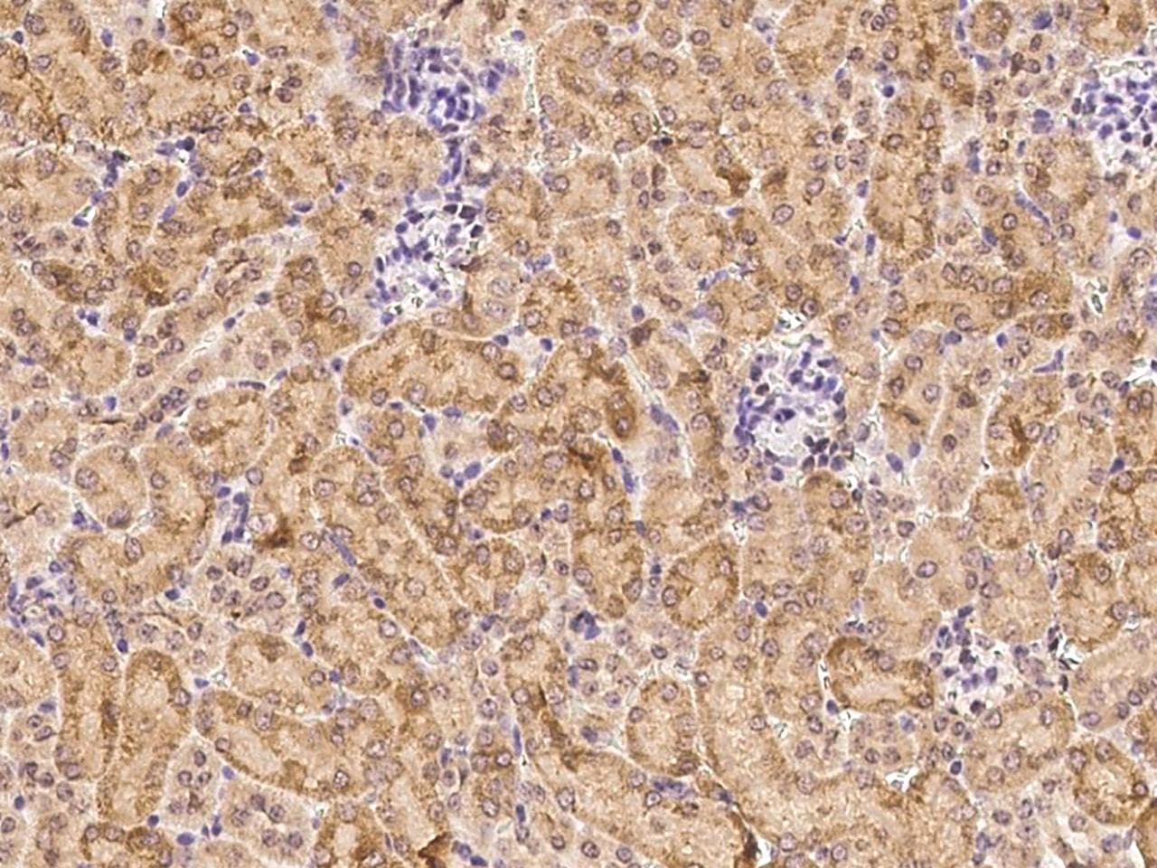 Polyclonal Rabbit anti-Mouse PDGF-D Antibody (Preservative Free, IHC)