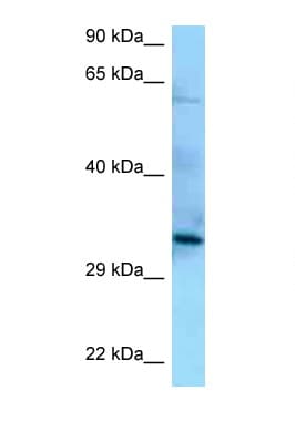 Polyclonal Rabbit anti-Human PPP6C Antibody (aa90-139, WB)