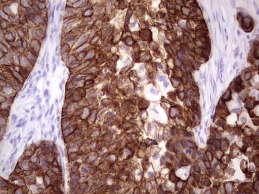 Monoclonal Mouse anti-Human Acidic Cytokeratin AE1 Antibody (clone AE1, IHC)
