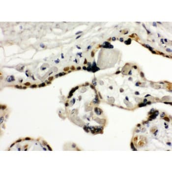 TRIM33 / TIF1-Gamma Antibody (aa1001-1127)