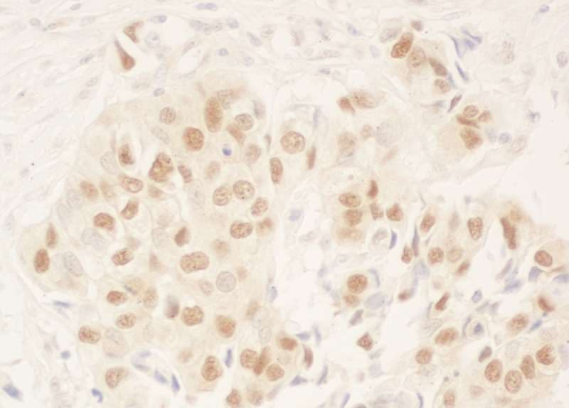 Polyclonal Rabbit anti-Human DCAF6 / NRIP Antibody (aa600-650, IHC, WB)
