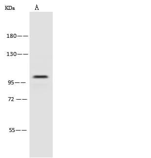 Polyclonal Rabbit anti-Human PSMD2 Antibody (WB)