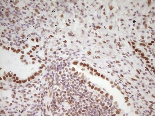 HMG20A Antibody (aa1-281, clone OTI2H4)