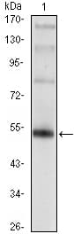FOXP3 Antibody (clone 4C7)