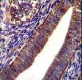 COL21A1 / Collagen XXI Antibody (aa204-232)