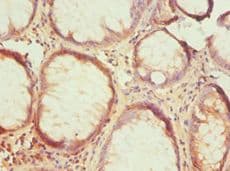 HTRA2 / OMI Antibody (aa334-458)