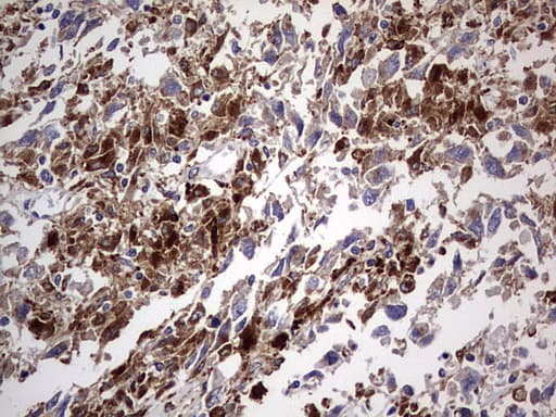 Monoclonal Mouse anti-Human CD63 Antibody (clone OTI5E5, IHC, WB)