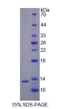 Mouse RETN / Resistin Protein (Recombinant His-T7)