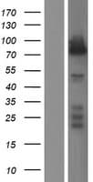 Band 4.1 / EPB41 Protein (Over-Expression Lysate Myc-DDK (Flag))