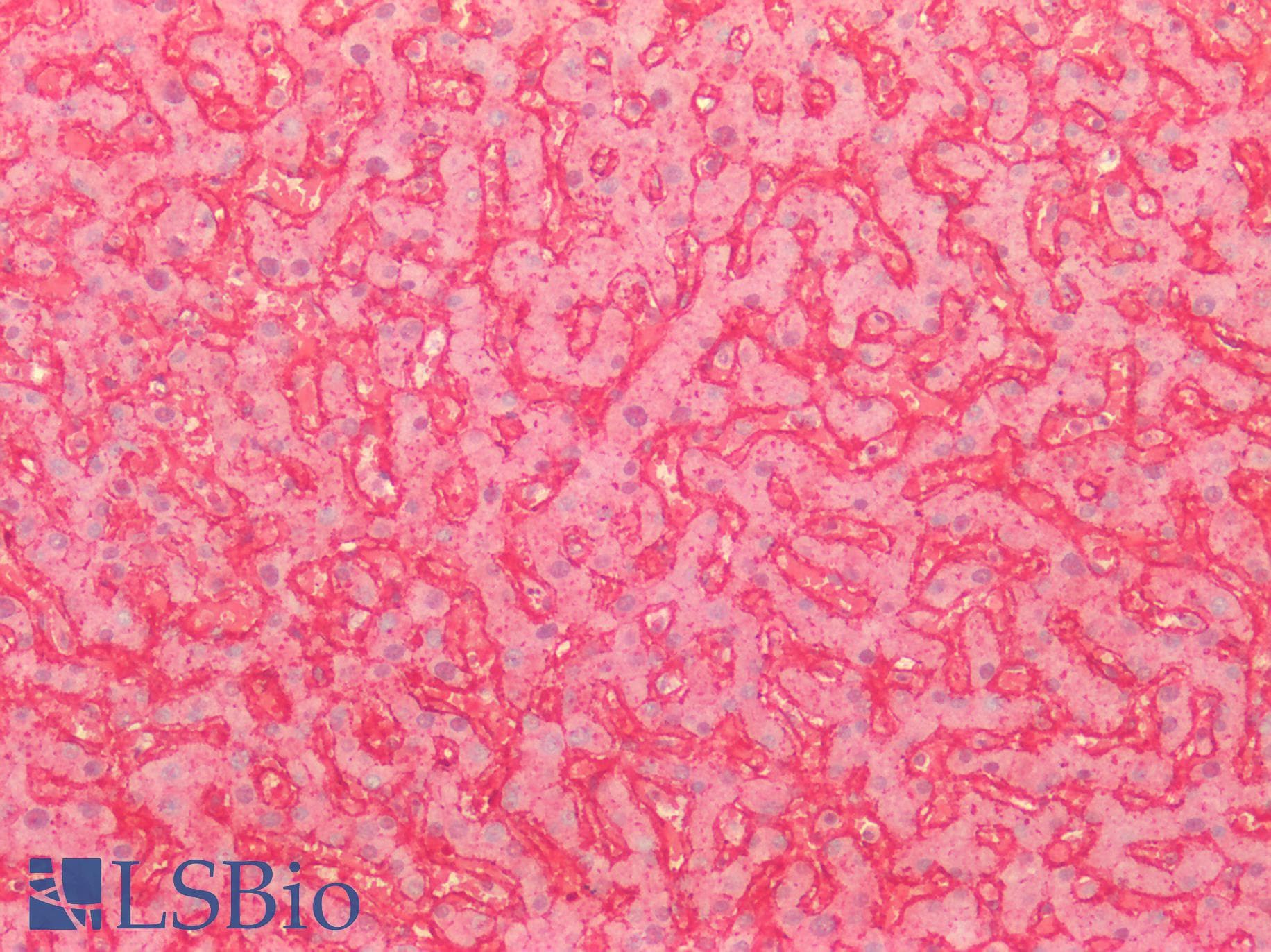 PathPlus™ CD81 Antibody (90-210 aa, Internal)