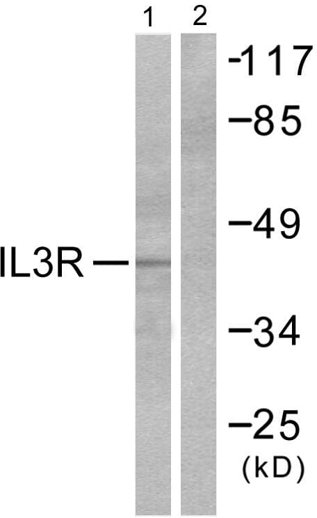 Polyclonal Rabbit anti-Human IL3RA / CD123 Antibody (p593, IHC, WB)
