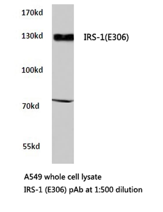 IRS1 Antibody (Glu306)