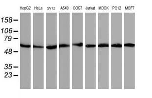 AKT1 Antibody (clone OTI4D6)