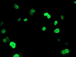 UNG / Uracil DNA Glycosylase Antibody (clone OTI1A11)