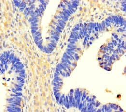 USP3 / UBP Antibody