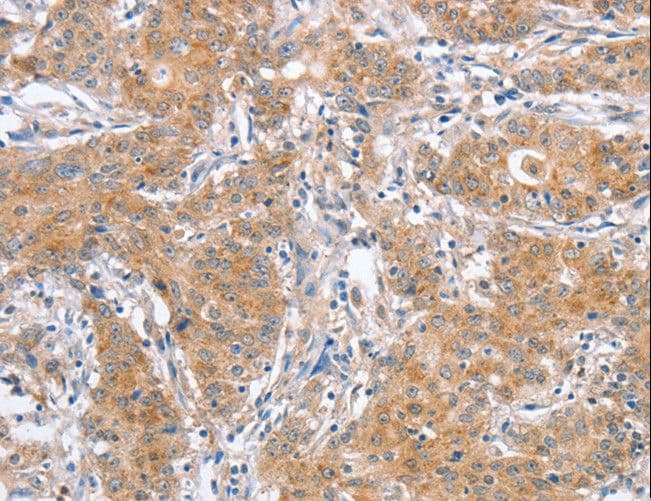 APG12 / ATG12 Antibody