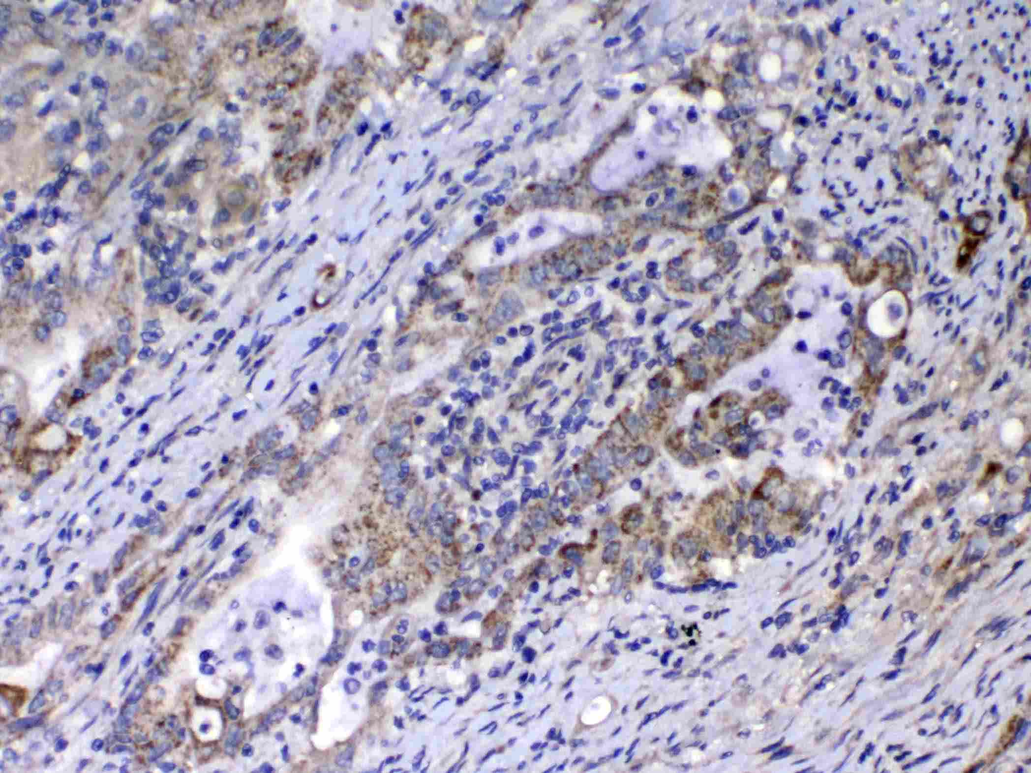 Polyclonal Rabbit anti-Human RLN1 / Relaxin Antibody (IHC, WB)