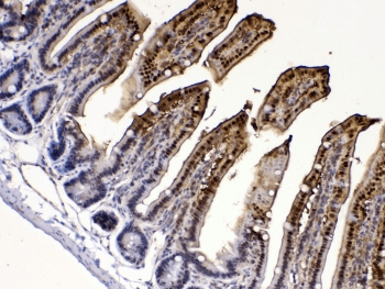 Polyclonal Rabbit anti-Human I-FABP / FABP2 Antibody (IHC, WB)