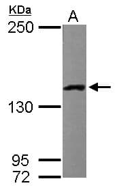 Polyclonal Rabbit anti-Human LRPPRC Antibody (aa611-937, IHC, WB)