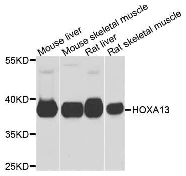 HOXA13 Antibody
